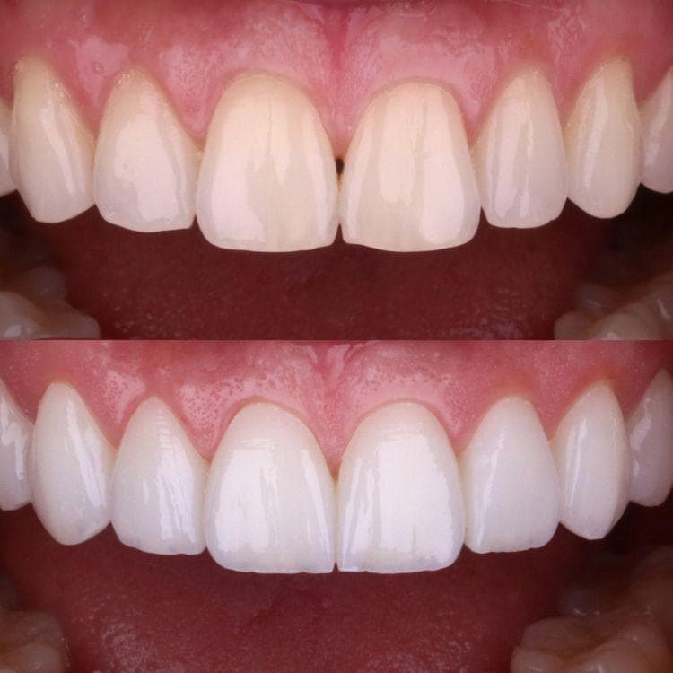 QB Dental