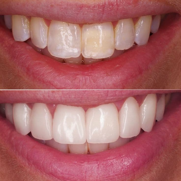 QB Dental