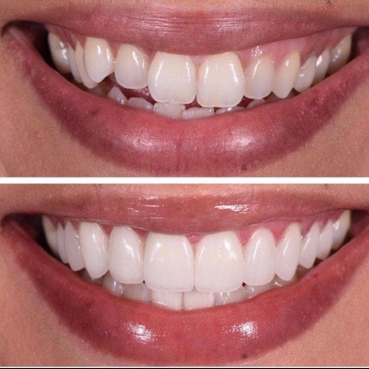 QB Dental