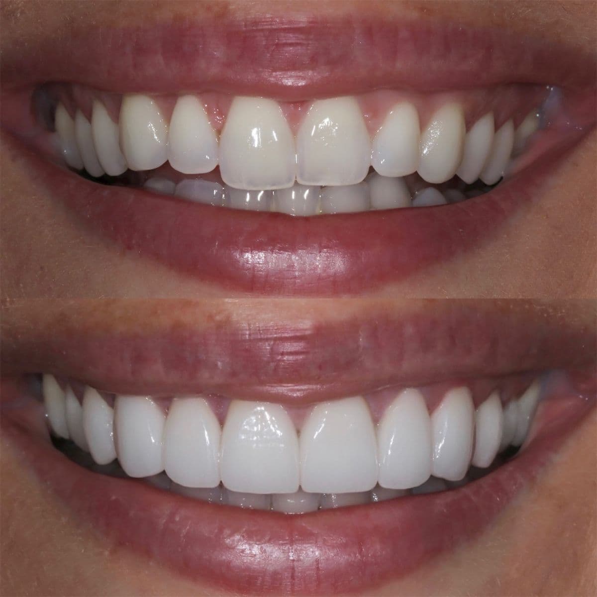 QB Dental
