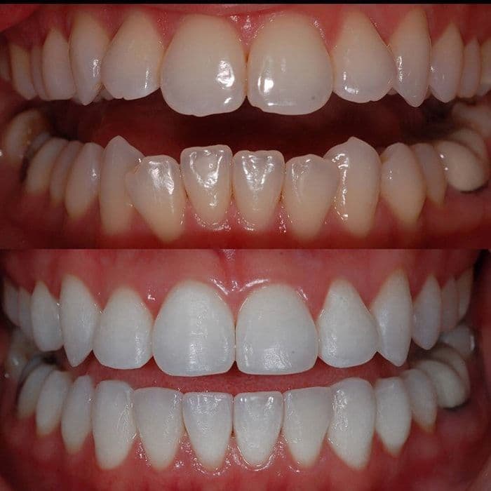 QB Dental
