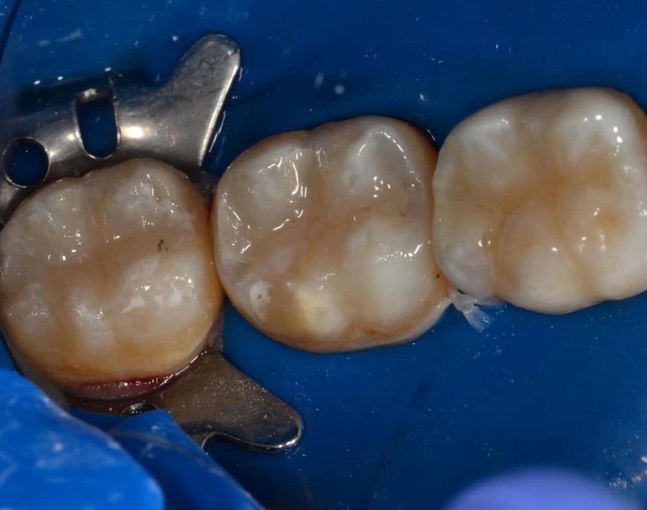 QB Dental